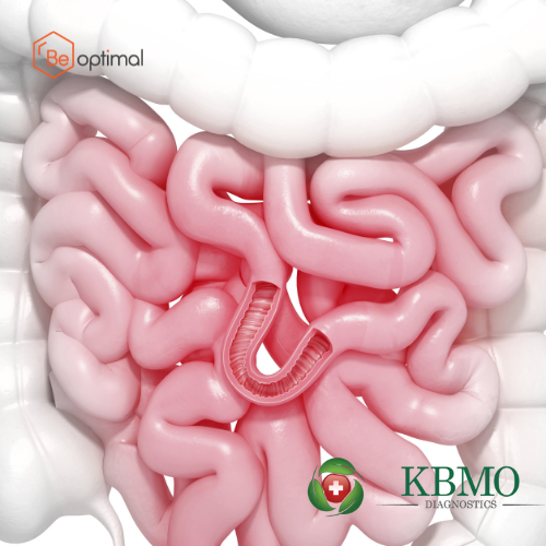 KBMO Leaky Gut Panel