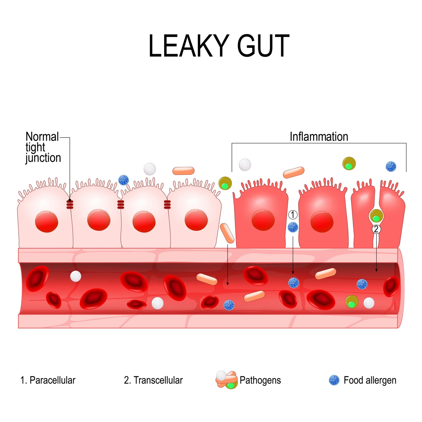 KBMO Leaky Gut Panel